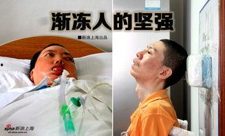 渐冻人生,挑战与希望的交织之旅